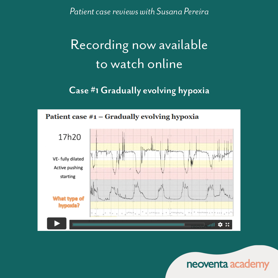 Recording of patient case review 1 now available to watch online